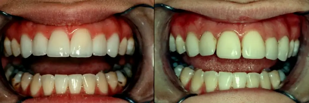 Pleasanton Yerondopoulos Dental