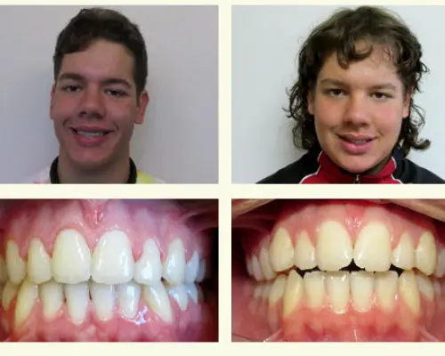 Olympia Perlot Orthodontics
