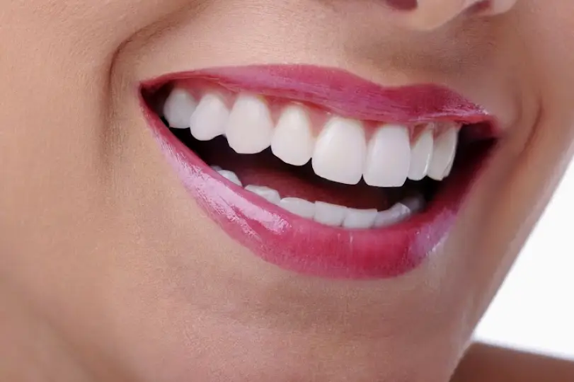 Cupertino Infantino Dental - Dr. Nick Infantino DDS