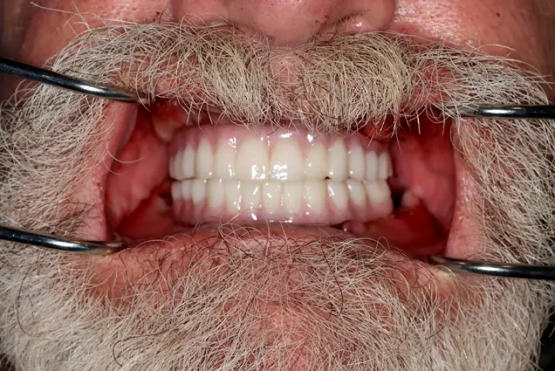  Elk Grove Ora Dental Implant Studio