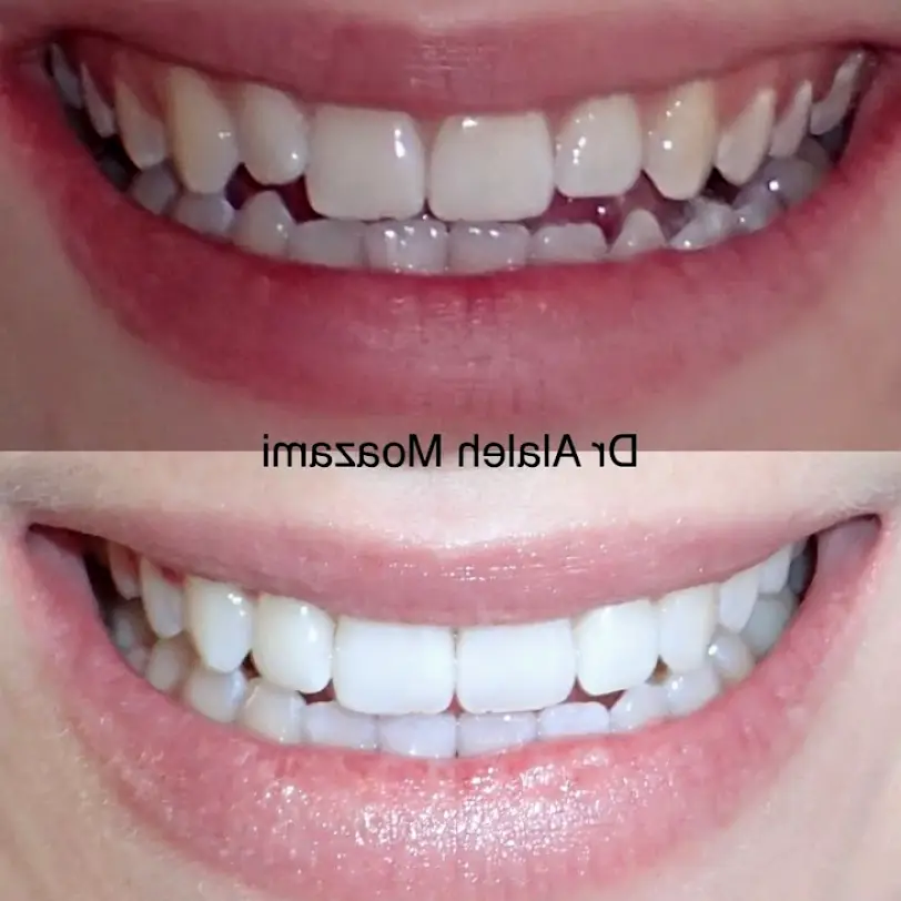 Kirkland Lake Washington Dental