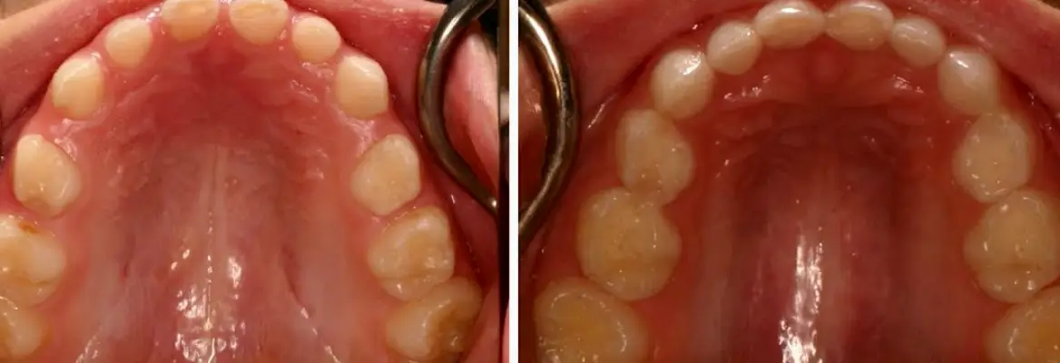 Medford Dentist - Dr. Nathan Tanner DMD