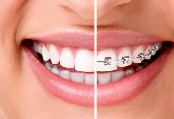 Tomball Rite Choice Dental Center