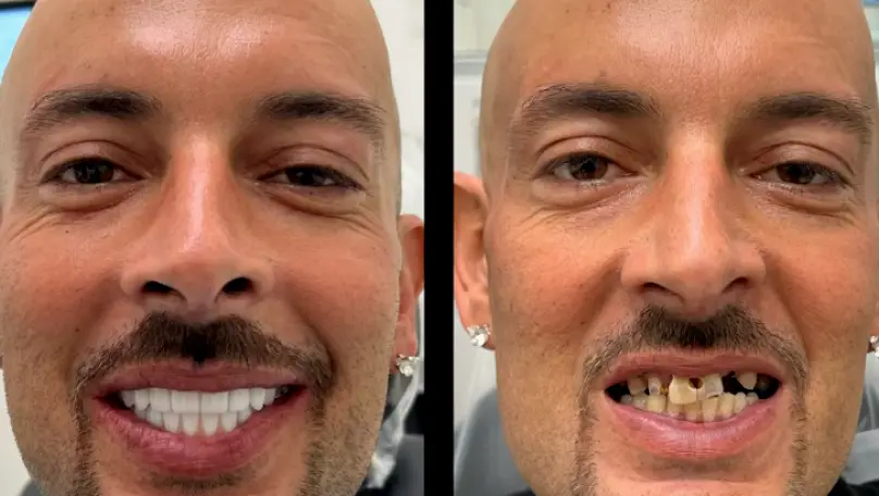 Tustin Global Implant Dentistry