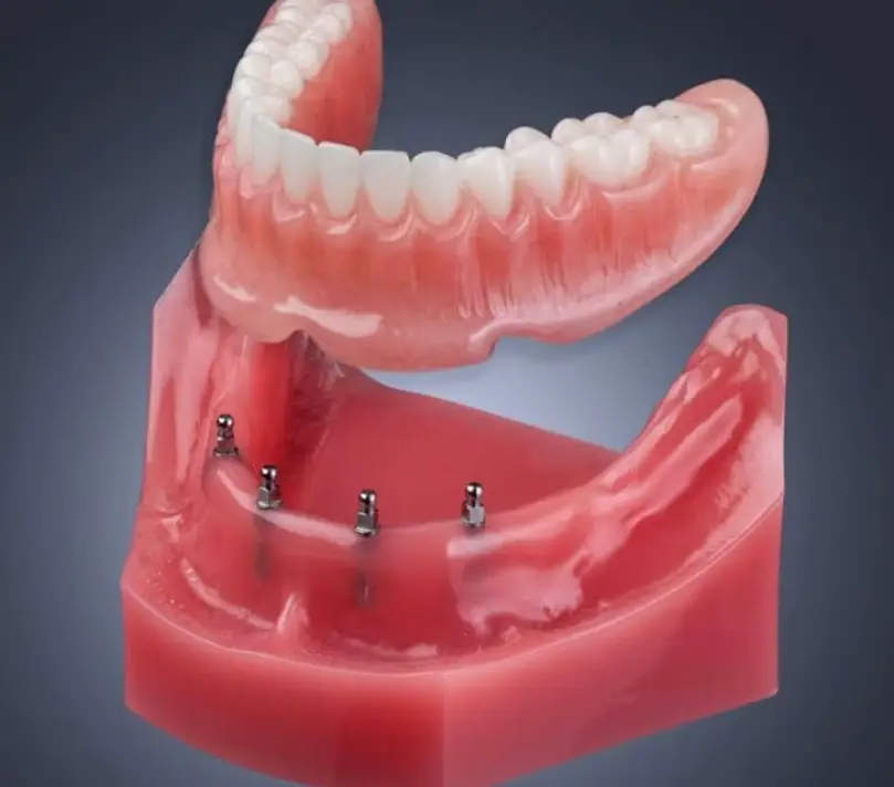  Mini Dental Implant Centers of America - Colorado Springs, CO