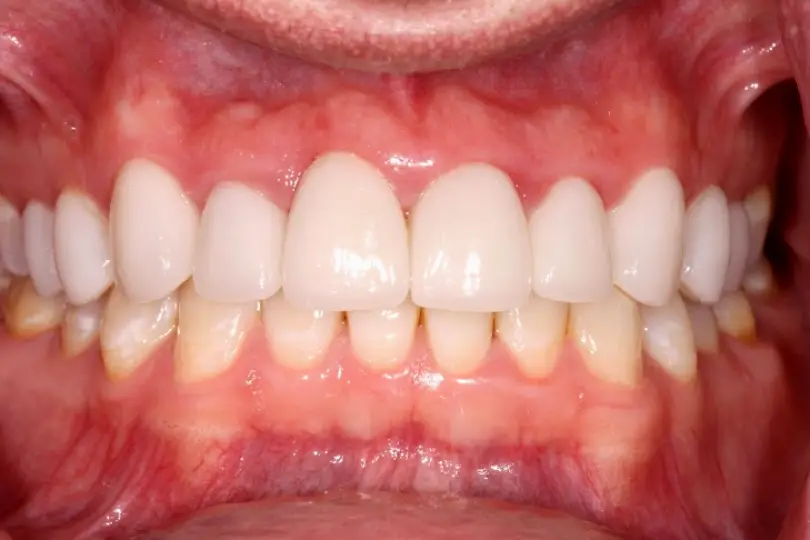 Croton Falls North Salem Dental Care