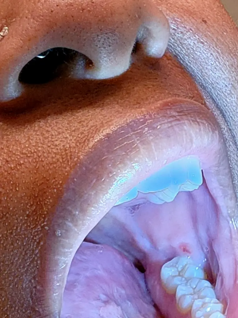  Humble Splendid Dental Care