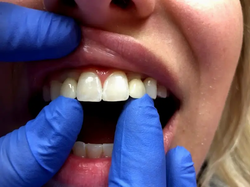 Rapid City Whillock Dental Arts