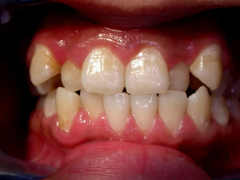 North York Seth Anant DDS