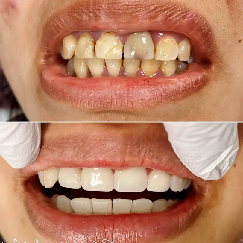 Plainfield Caton Crossing Dental Care