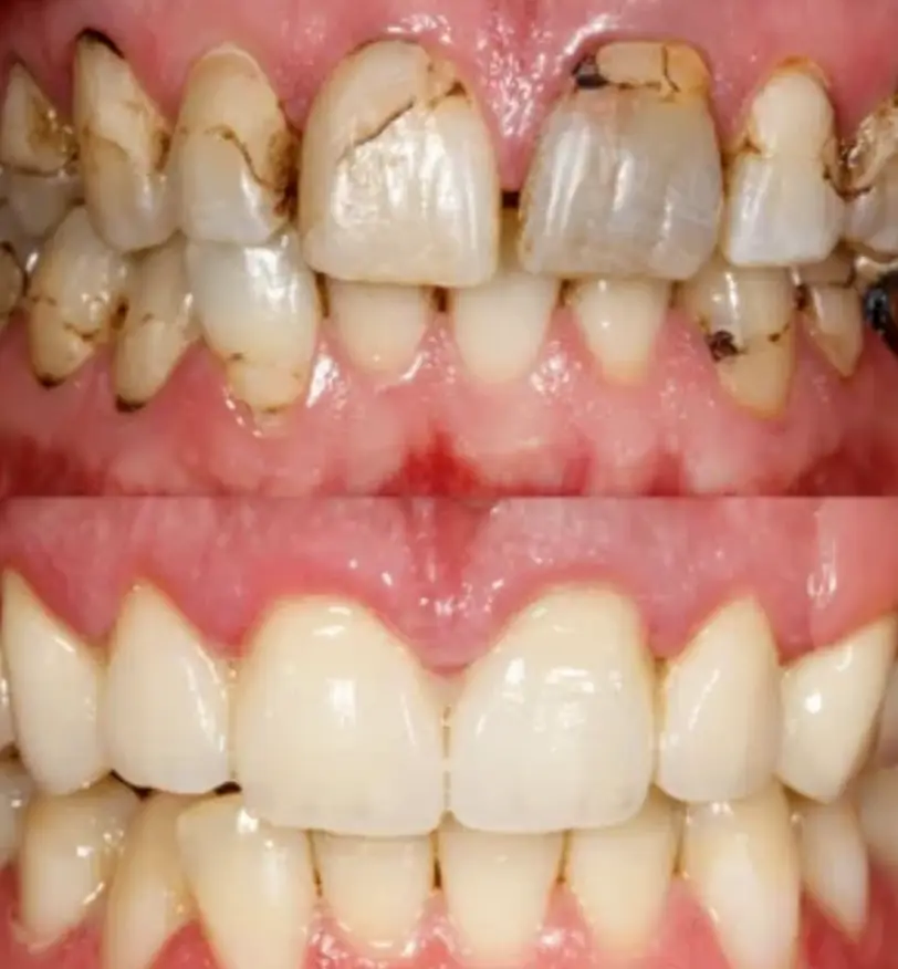 Advanced Dental Care Lakewood