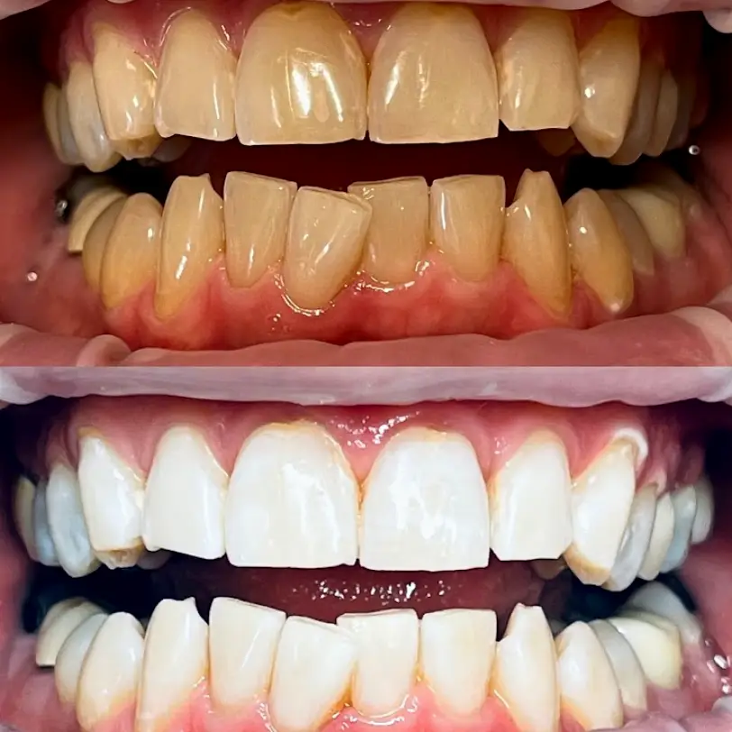 Menomonee Falls Riverside Family Dental