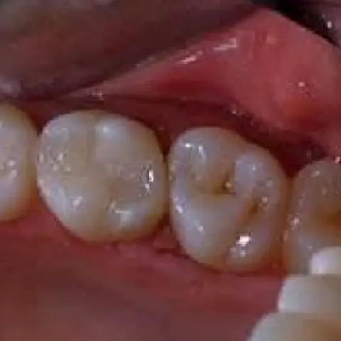 Millersville Family Dentistry