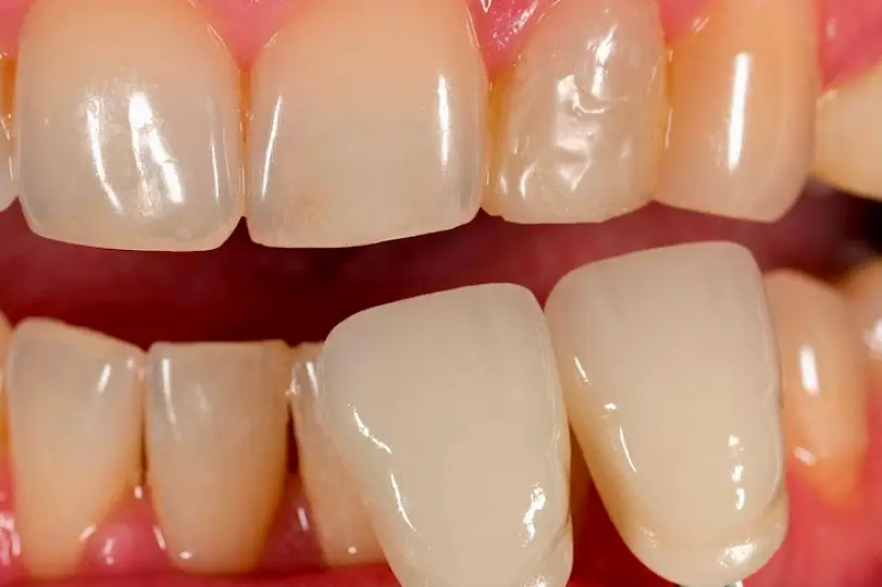 Greenwich In-House Dental Studio