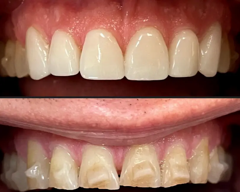 Issaquah Creek Dental