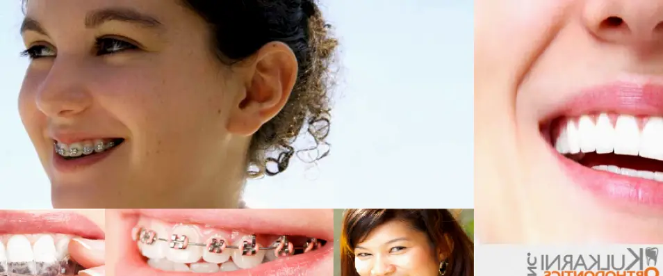 Springboro Kulkarni Orthodontics