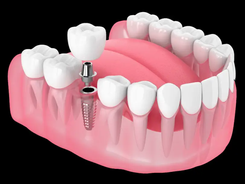  Norwalk Dentistry & Implants