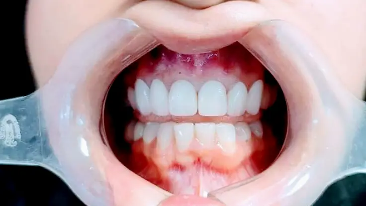 Nuevo Progreso Majestic family dental