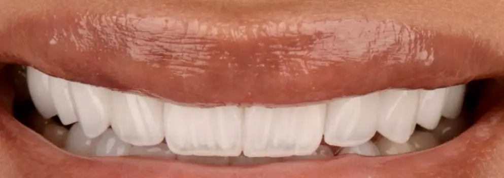 Kissimmee Central Florida Cosmetic & Family Dentistry