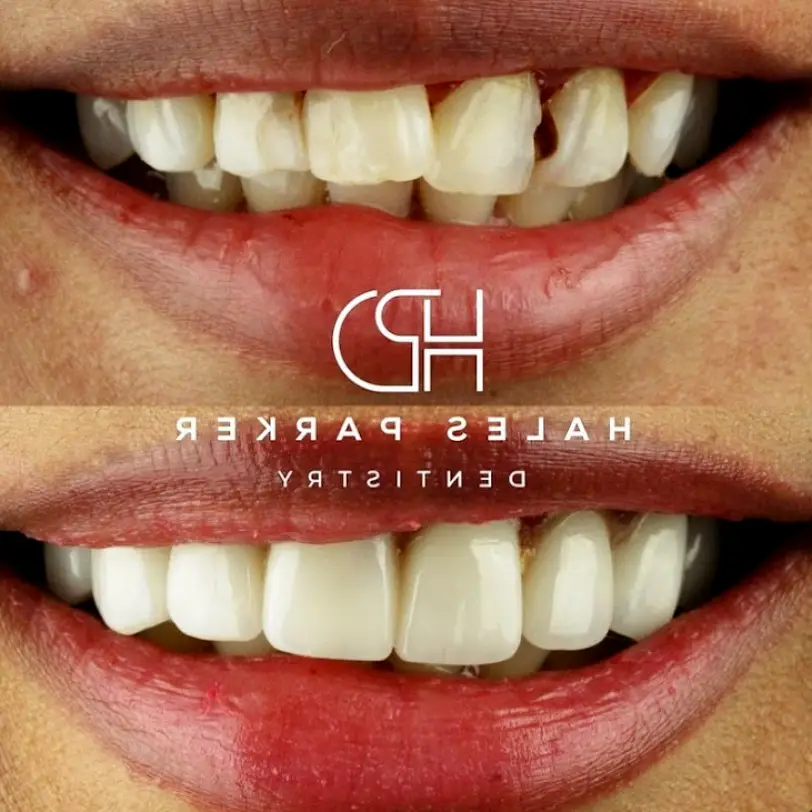 Ladera Ranch Facer Hales Parker Dentistry