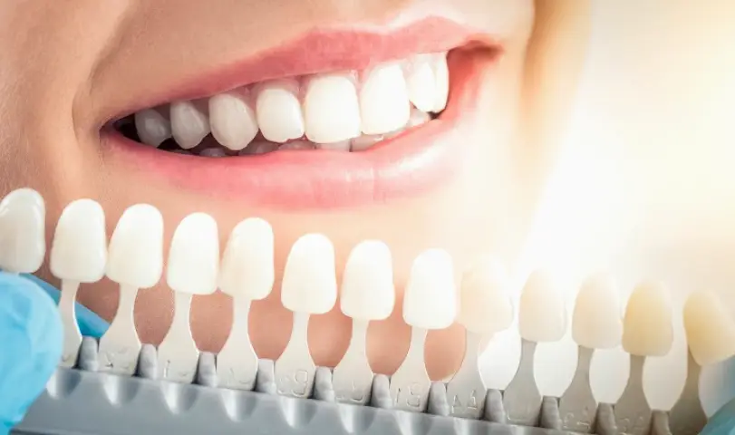  Cosmetic Dentist Huntington Beach - Ayoub Dental Corp - Emergency Dentist Huntington Beach CA - Dr. Sam Ayoub, DDS