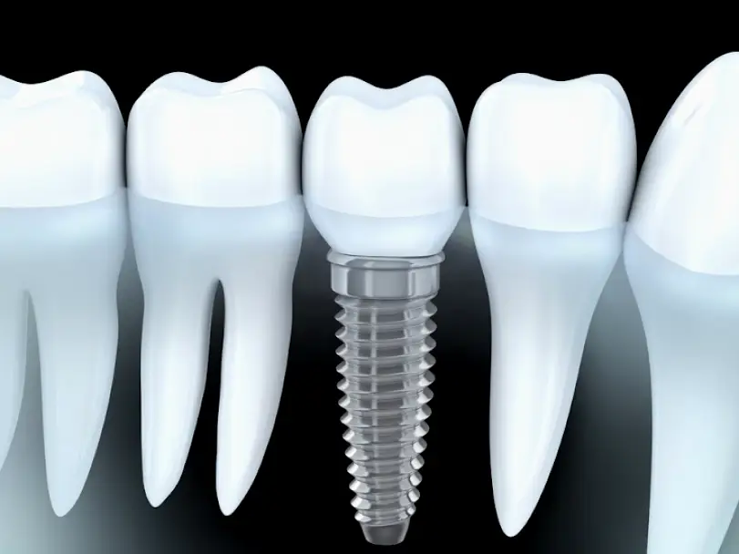 Dania Beach Emergency Dental