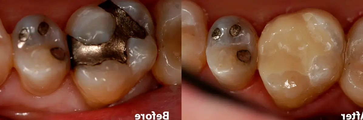  Emergency Dentist 24/7 Redondo Beach