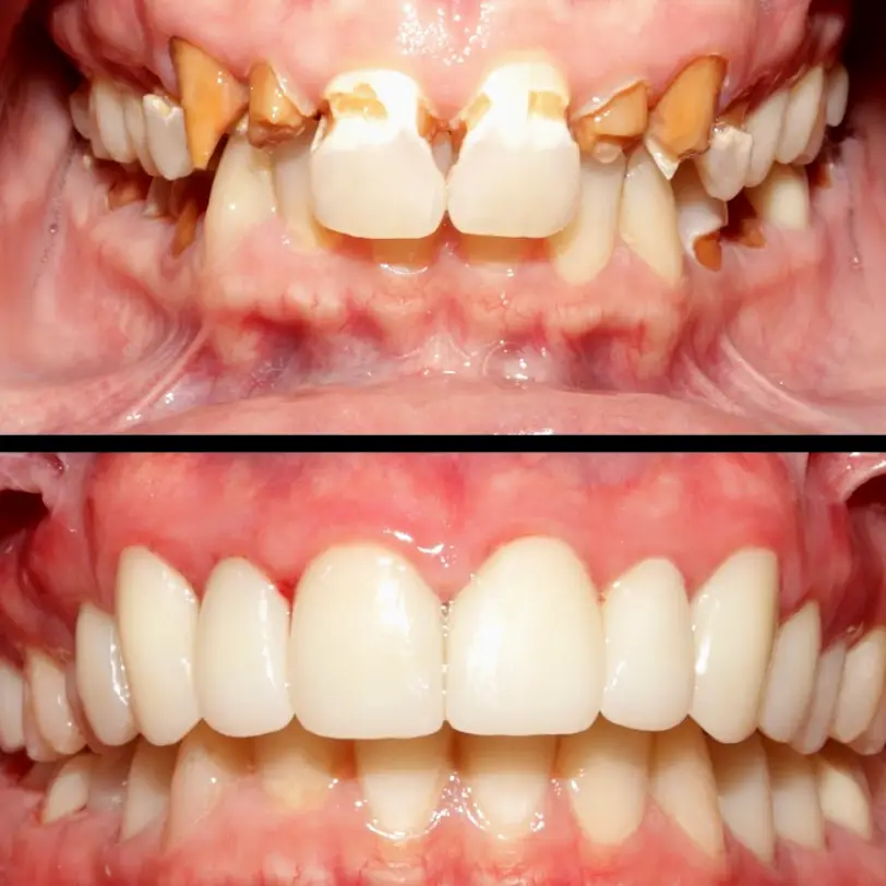 Hurst Lamina Dental Ceramics