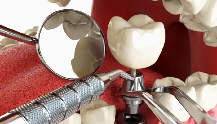 Pawleys Island Winyah Dental Group of Pawley's