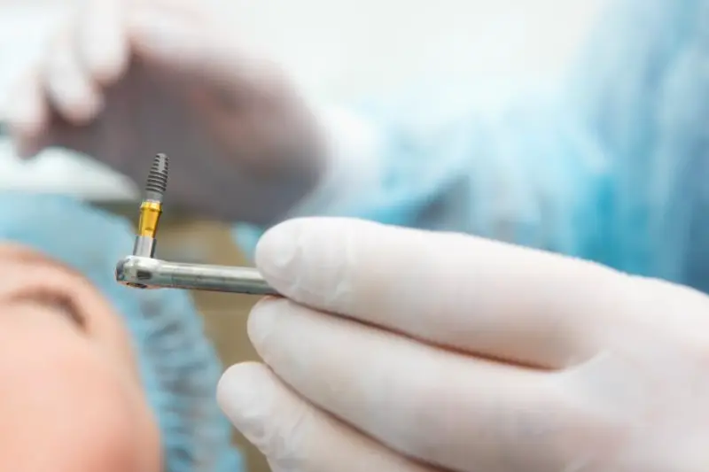 Simi Valley Periodontics