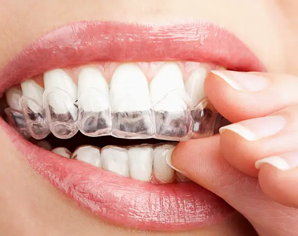 Hartford Smiles Dental