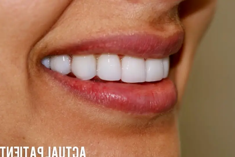 Menlo Park Family Dental