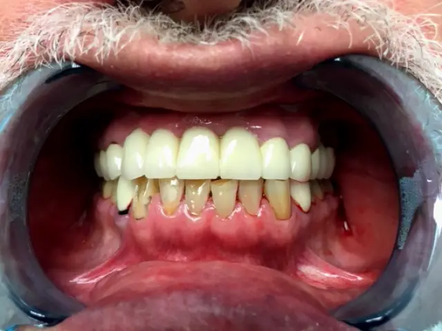 PhD Dental Inglewood Adults, Kids, Implants & Orthodontics