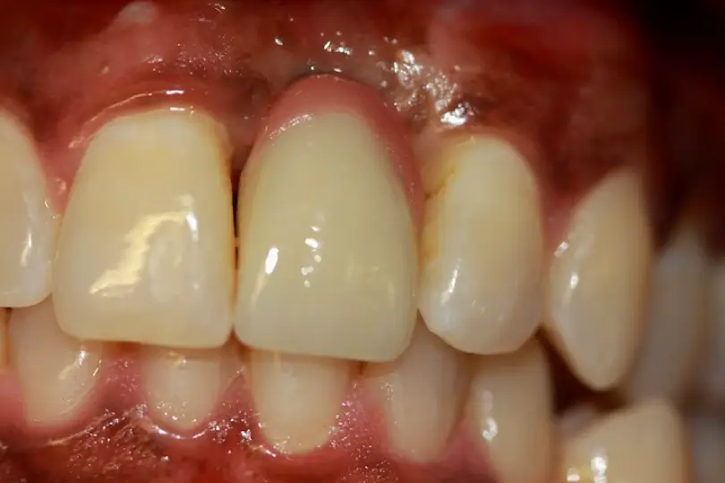 Manhattan Beach Ocean View Dental Group