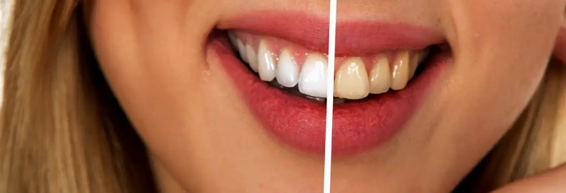 Stephen J Pere DMD- Your Bradenton Dentist