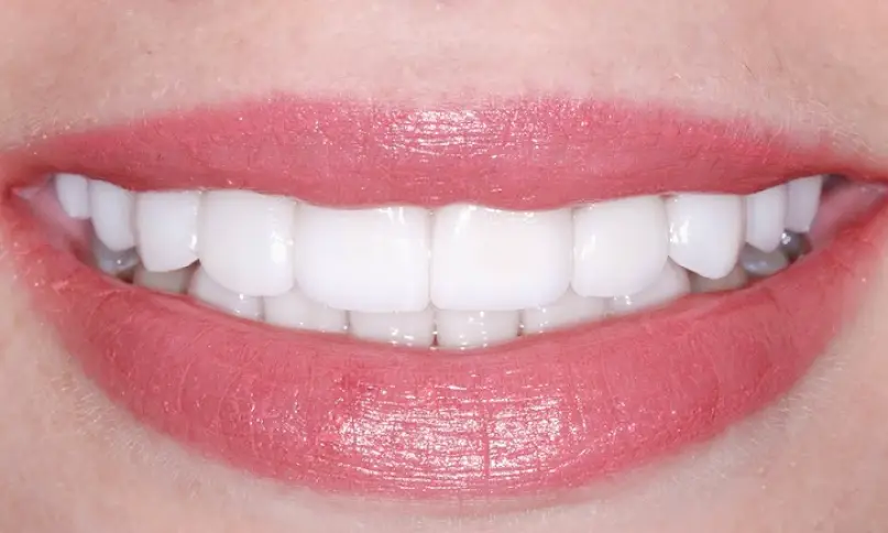 Draper Elite Smiles by Walter Meden DDS