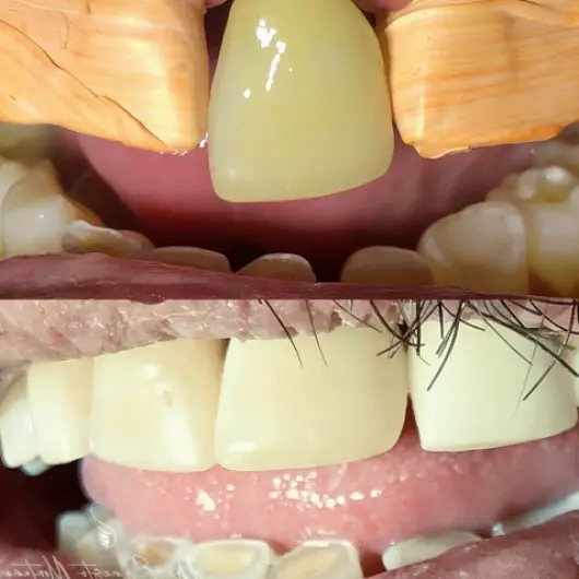Ensenada Dr. Ernesto Antonio Montaño Pérez, Dentista - Odontólogo
