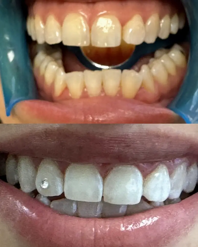 Odessa WhitenUpSmiles