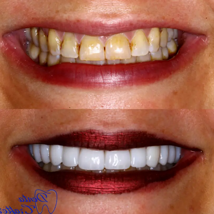 Falls Church DentaCrafters PLLC