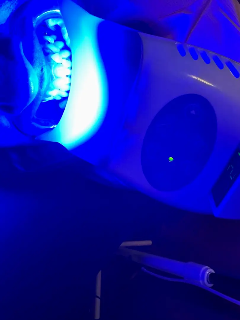 Duncanville Crown by Cole Teeth Whitening and More