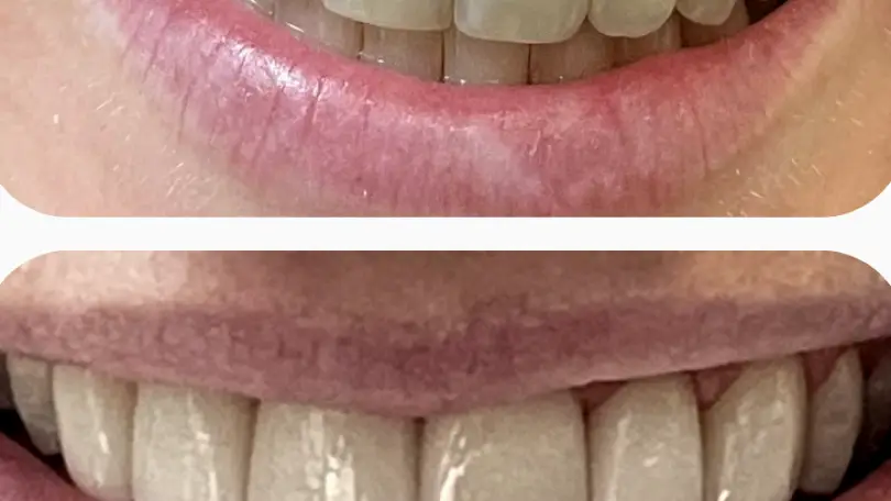 Denville Stephen Lashen, DDS