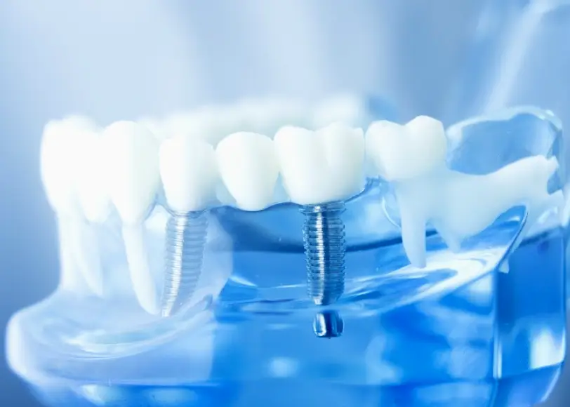 Milpitas Montague Hills Dentistry