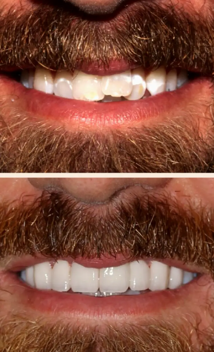 Mountain Brook StoneCreek Dental Care - Birmingham Montclair