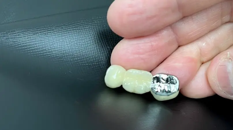  McAllen Whitewing Dental