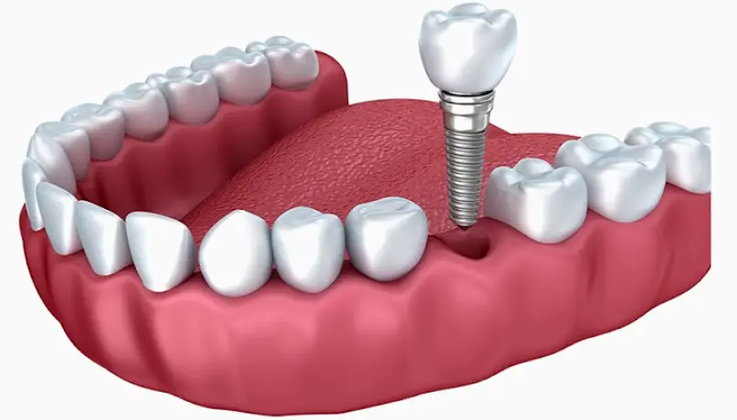  PearlFection Dentistry - Urbana
