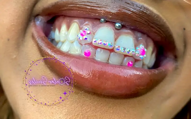 Chester Soular Smiles Teeth Whitening & Tooth Gems