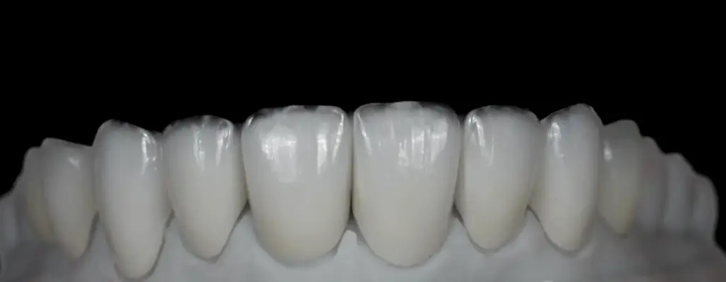 Springfield Delfin Romani DMD Cosmetic Dentistry and Implants
