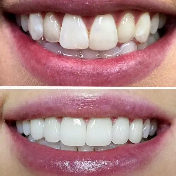 Pure Dental of Murrieta & Orthodontics