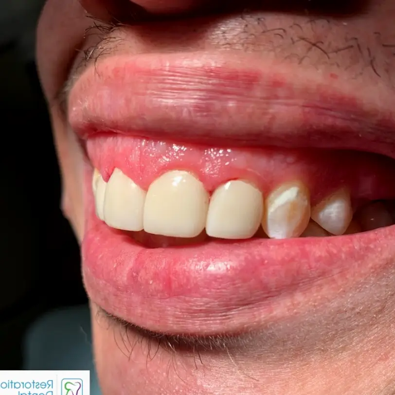 Huntington Woods Restoration Dental