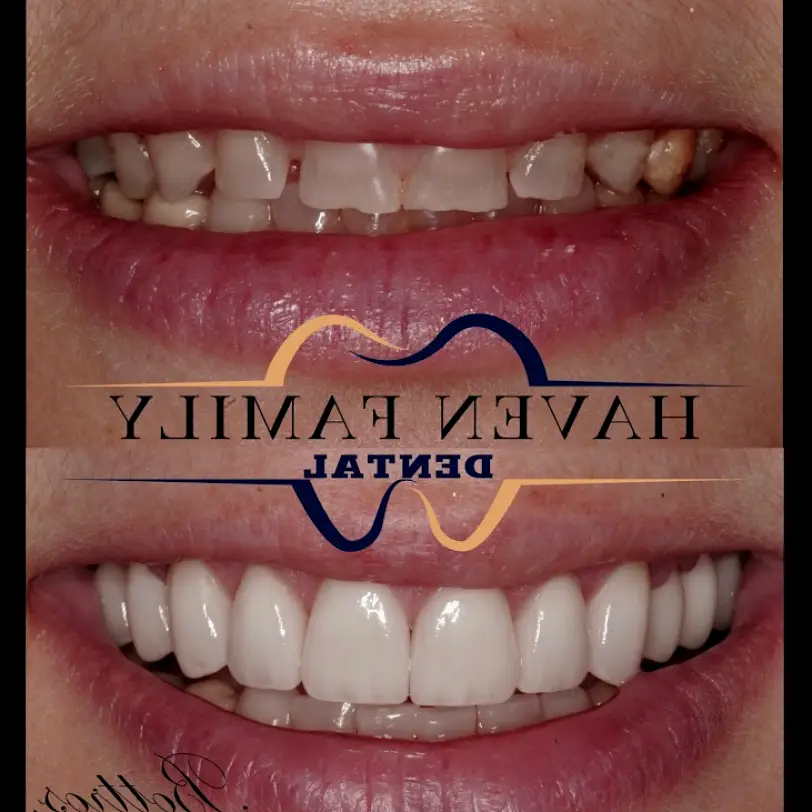Joliet Haven Family Dental - Dr. Bottros and Dr. Bebar